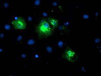 Immunocytochemistry/ Immunofluorescence: LPAR1/LPA1/EDG-2 Antibody (OTI1G6) [NBP2-01354]