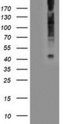 Western Blot: LPAR1/LPA1/EDG-2 Antibody (OTI1G6) [NBP2-01354]