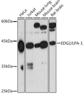 Western Blot: LPAR1/LPA1/EDG-2 Antibody (3U1Q0) [NBP3-15851]