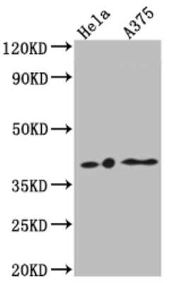 Western Blot: LPAR1/LPA1/EDG-2 Antibody (4C3) [NBP3-15186]