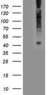 Western Blot: LPAR1/LPA1/EDG-2 Antibody (OTI1G6)Azide and BSA Free [NBP2-72519]