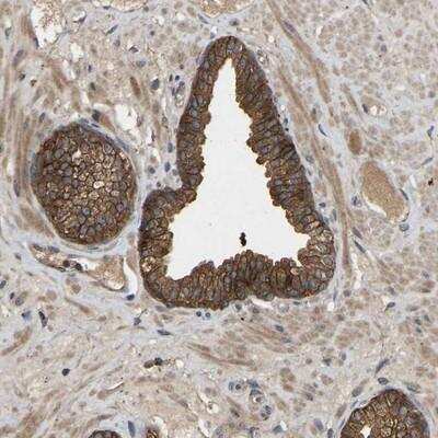 Immunohistochemistry-Paraffin: LPAR2/LPA2/EDG-4 Antibody [NBP1-84904]