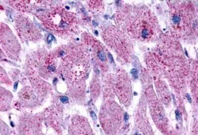 Immunohistochemistry-Paraffin: LPAR3/LPA3/EDG-7 Antibody - BSA Free [NLS1017]