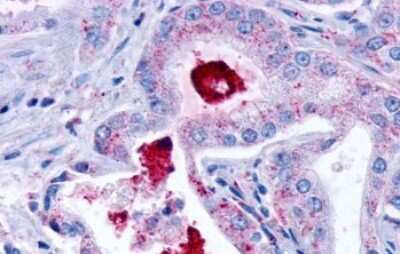 Immunohistochemistry-Paraffin: LPAR3/LPA3/EDG-7 Antibody - BSA Free [NLS1017]