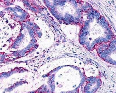 Immunohistochemistry-Paraffin: LPAR3/LPA3/EDG-7 Antibody - BSA Free [NLS1017]