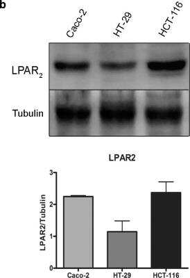 Western Blot: LPAR2/LPA2/EDG-4 Antibody [NBP1-84904]