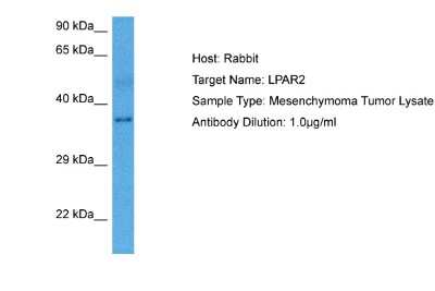 Western Blot: LPAR2/LPA2/EDG-4 Antibody [NBP2-87735]