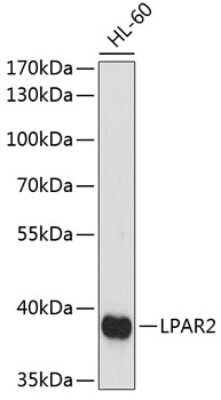 Western Blot: LPAR2/LPA2/EDG-4 AntibodyAzide and BSA Free [NBP3-02981]