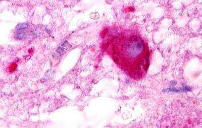 Immunohistochemistry-Paraffin: LPAR5/LPA5/GPR92 Antibody - BSA Free [NLS428]