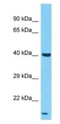 Western Blot: LPAR6/P2RY5 Antibody [NBP3-09507]