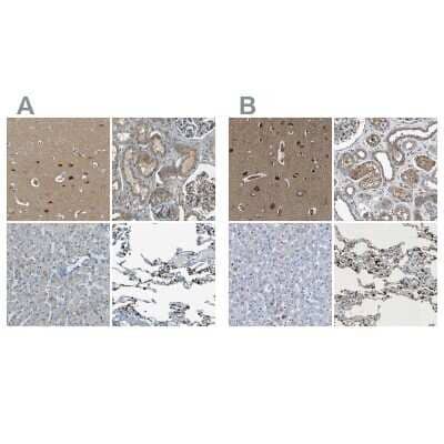 Immunohistochemistry-Paraffin: LPCAT1 Antibody [NBP1-88922]