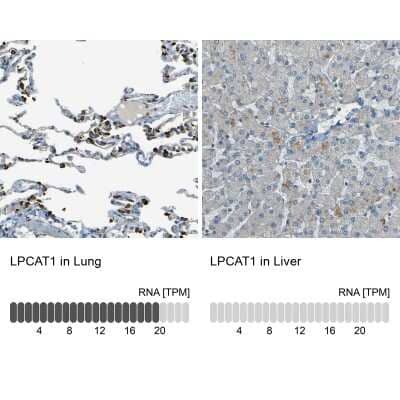 Immunohistochemistry-Paraffin: LPCAT1 Antibody [NBP1-88922]