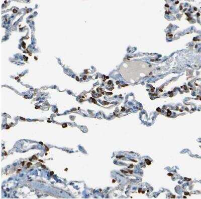 Immunohistochemistry-Paraffin: LPCAT1 Antibody [NBP1-88922]