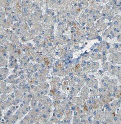 Immunohistochemistry-Paraffin: LPCAT1 Antibody [NBP1-88922]