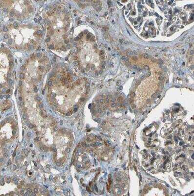 Immunohistochemistry-Paraffin: LPCAT1 Antibody [NBP1-88922]