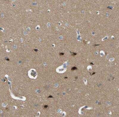 Immunohistochemistry-Paraffin: LPCAT1 Antibody [NBP1-88922]