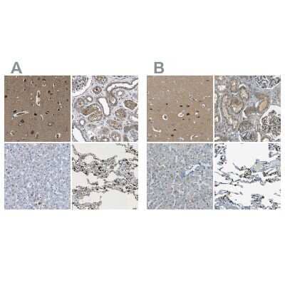 Immunohistochemistry-Paraffin: LPCAT1 Antibody [NBP1-88923]