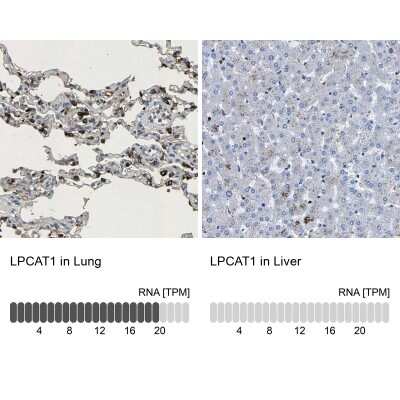 Immunohistochemistry-Paraffin: LPCAT1 Antibody [NBP1-88923]