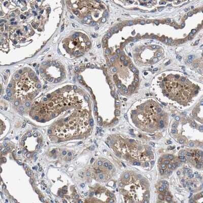 Immunohistochemistry-Paraffin: LPCAT1 Antibody [NBP1-88923]