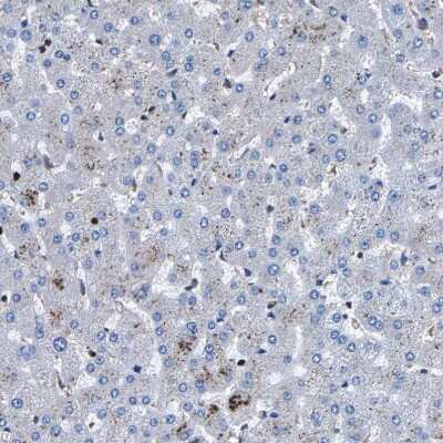 Immunohistochemistry-Paraffin: LPCAT1 Antibody [NBP1-88923]