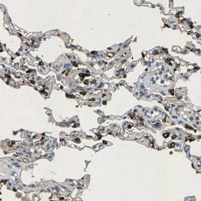Immunohistochemistry-Paraffin: LPCAT1 Antibody [NBP1-88923]