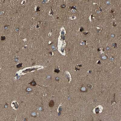 Immunohistochemistry-Paraffin: LPCAT1 Antibody [NBP1-88923]