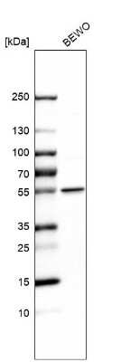 Western Blot: LPCAT1 Antibody [NBP1-88922]