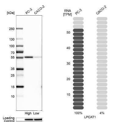 Western Blot: LPCAT1 Antibody [NBP1-88923]