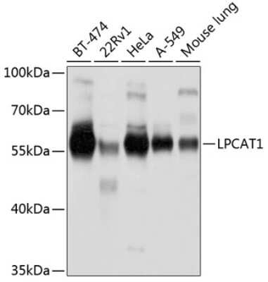 Western Blot: LPCAT1 AntibodyBSA Free [NBP3-04963]