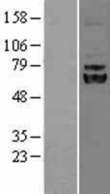 Western Blot: LPCAT1 Overexpression Lysate [NBL1-12648]