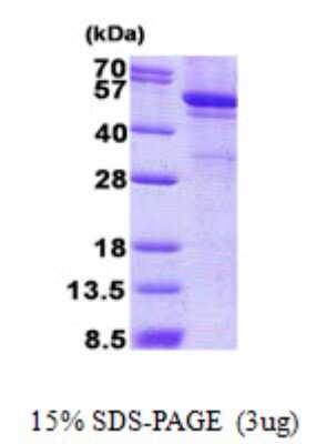 SDS-PAGE: Recombinant Human LPCAT1 His Protein [NBP2-23206]