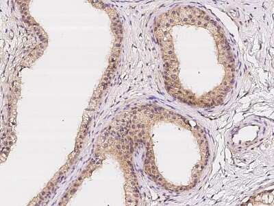 Immunohistochemistry-Paraffin: LPCAT2 Antibody [NBP2-97211]