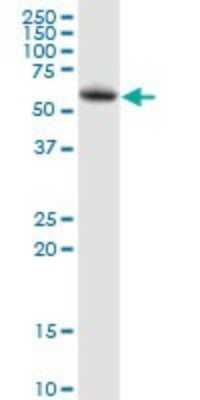Western Blot: LPCAT2 Antibody [H00054947-B01P]