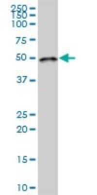 Western Blot: LPCAT2 Antibody [H00054947-B01P]