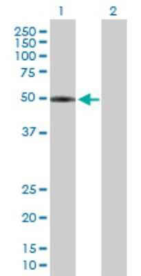 Western Blot: LPCAT2 Antibody [H00054947-B01P]
