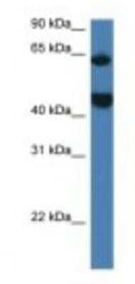 Western Blot: LPCAT2 Antibody [NBP1-79206]