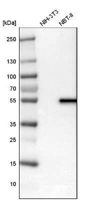 Western Blot: LPCAT2 Antibody [NBP1-88921]