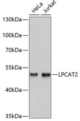 Western Blot: LPCAT2 AntibodyBSA Free [NBP3-04756]