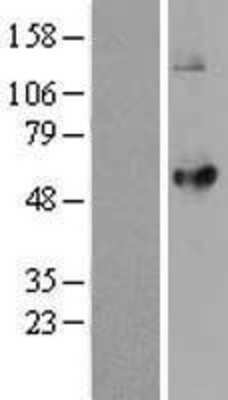 Western Blot: LPCAT2 Overexpression Lysate [NBL1-12649]