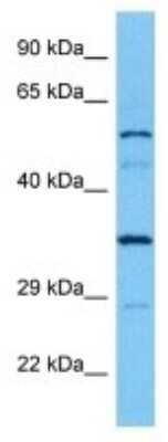 Western Blot: LPCAT3 Antibody [NBP3-10074]