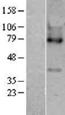 Western Blot: LPCAT3 Overexpression Lysate [NBP2-04299]