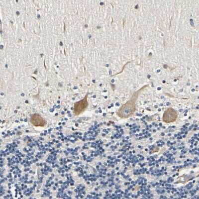 Immunohistochemistry-Paraffin: LPGAT1 Antibody [NBP1-83929]