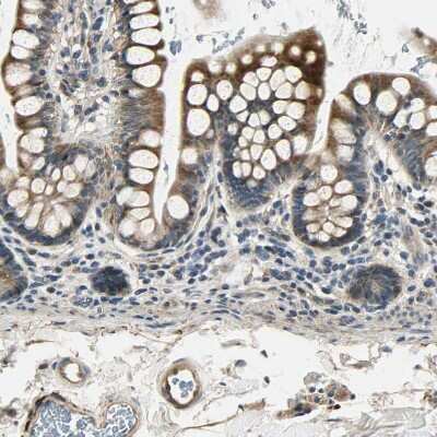 Immunohistochemistry-Paraffin: LPGAT1 Antibody [NBP1-83929]