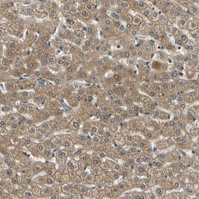 Immunohistochemistry-Paraffin: LPGAT1 Antibody [NBP1-83929]