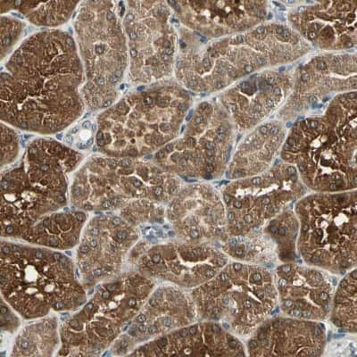 Immunohistochemistry-Paraffin: LPGAT1 Antibody [NBP1-83929]