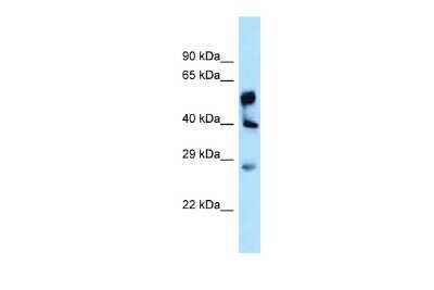 Western Blot: LPGAT1 Antibody [NBP2-85221]