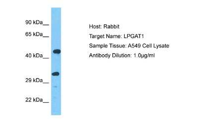 Western Blot: LPGAT1 Antibody [NBP2-85222]