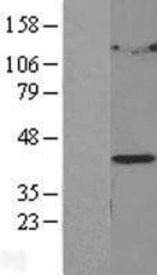 Western Blot: LPGAT1 Overexpression Lysate [NBL1-12652]