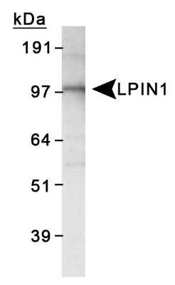 Western Blot: Lipin 1 AntibodyBSA Free [NB110-57150]