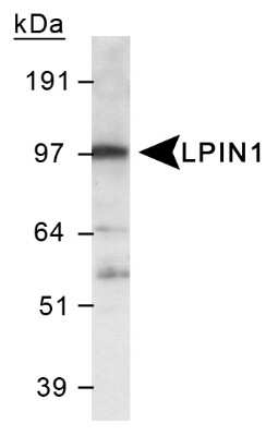 Western Blot: Lipin 1 AntibodyBSA Free [NB110-57151]